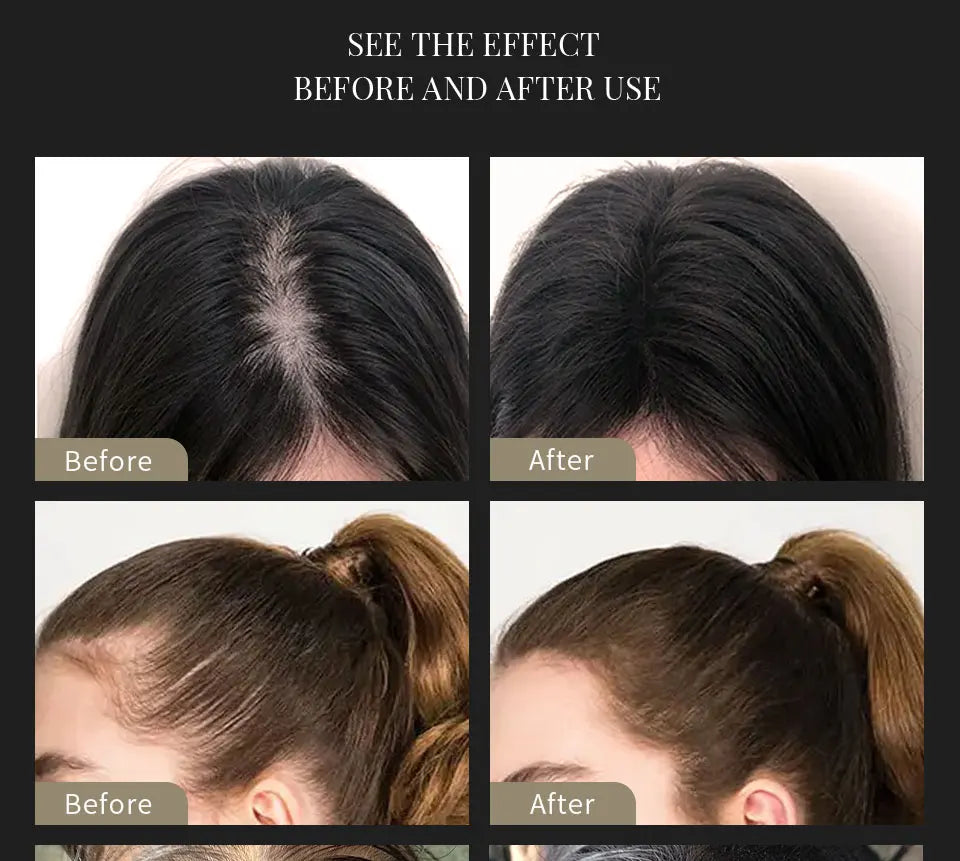 SEVICH Kit de fibres capillaires pour camoufler les zones clairsemées ou dégarnies - Traitement de repousse des cheveux et de la chute des cheveux - Applicateur de poudre de fibres capillaires à la kératine